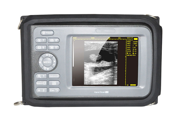 Handheld Ultrasound Scanner Machine Cardiac Micro-Convex Probe For Human Sale CE 190891435552 DIAGNOSTIC ULTRASOUND MACHINES FOR SALE