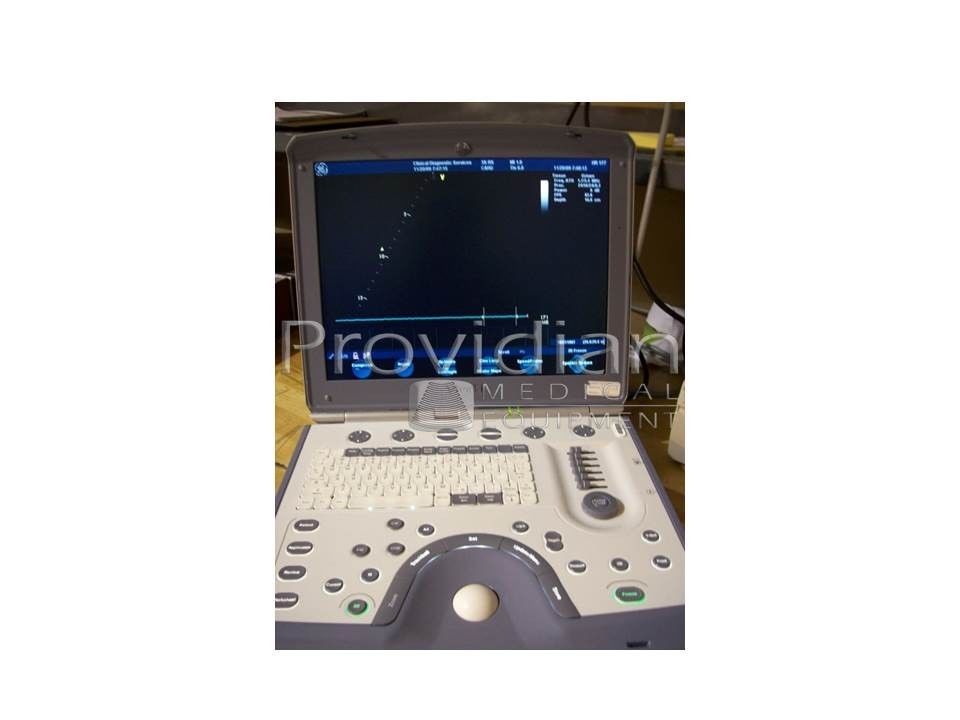 opened GE ultrasound