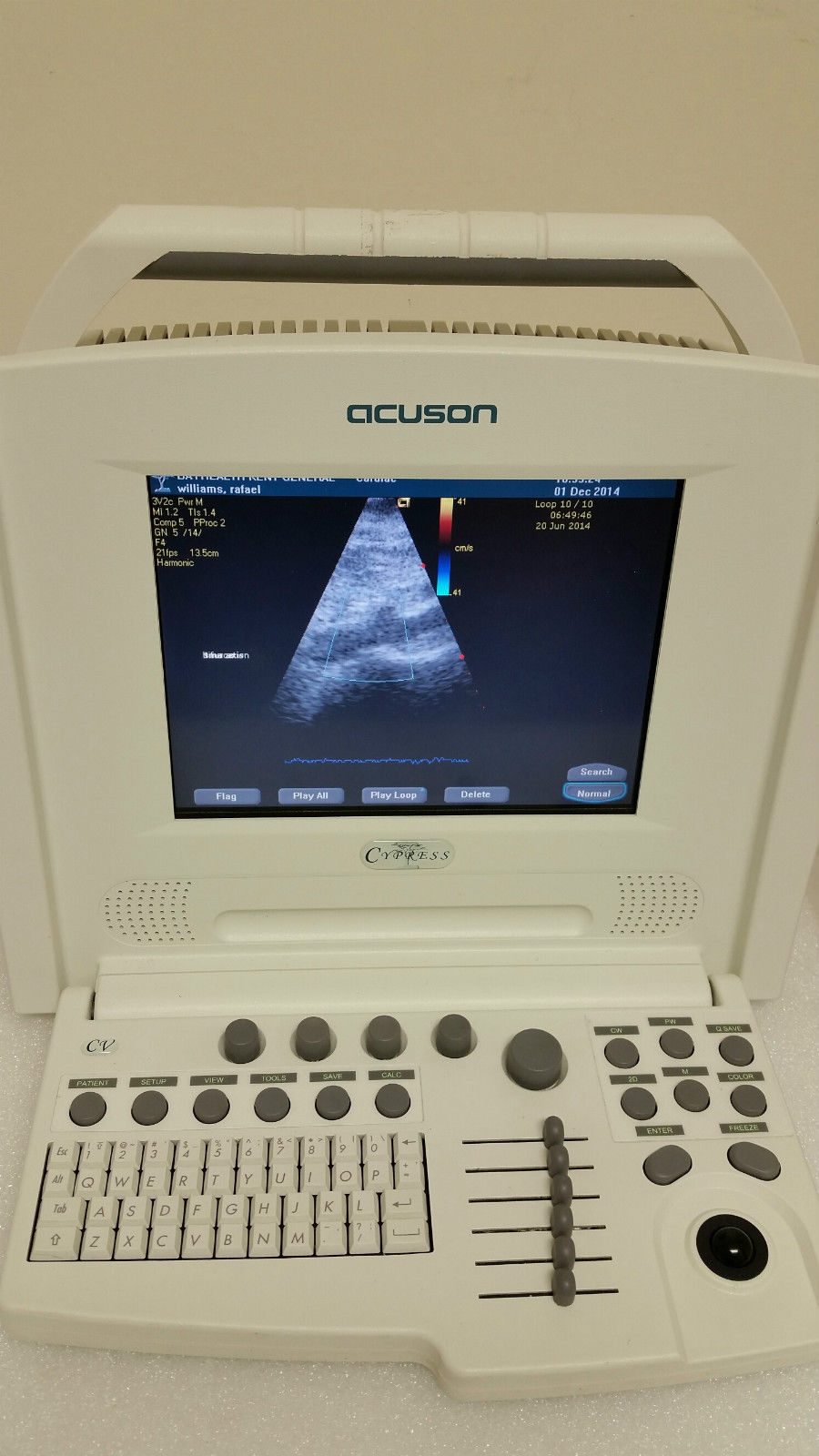 Acuson Cypress Cardiac Vascular Ultrasound Machine Rev 14 + CW, 3V2c, 7L3 Probe DIAGNOSTIC ULTRASOUND MACHINES FOR SALE