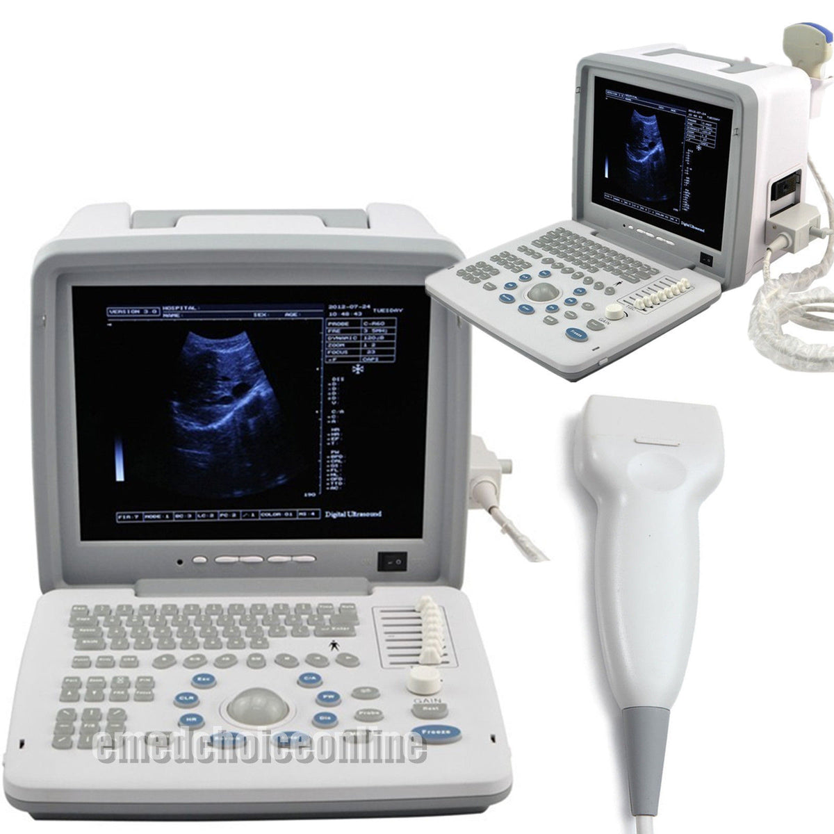 Portable Ultrasound Scanner/Machine +7.5MHz Linear Probe/Transducer Free 3D  190891434975 DIAGNOSTIC ULTRASOUND MACHINES FOR SALE