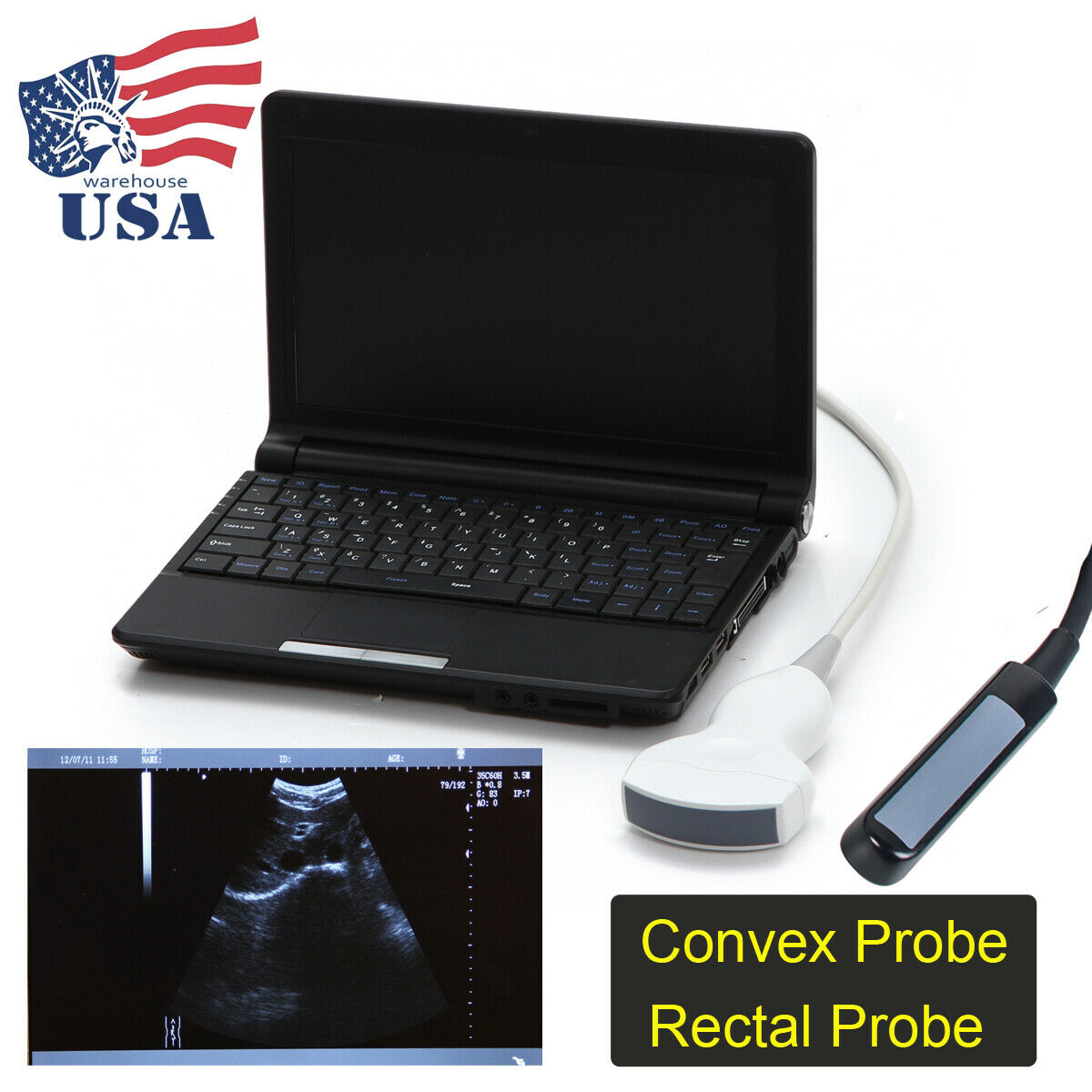 10" Full Digital Laptop Ultrasound Scanner Machine System + Convex Rectal Probe DIAGNOSTIC ULTRASOUND MACHINES FOR SALE