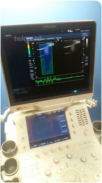 TOSHIBA APLIO 500 ULTRASOUND SYSTEM % (271929) DIAGNOSTIC ULTRASOUND MACHINES FOR SALE