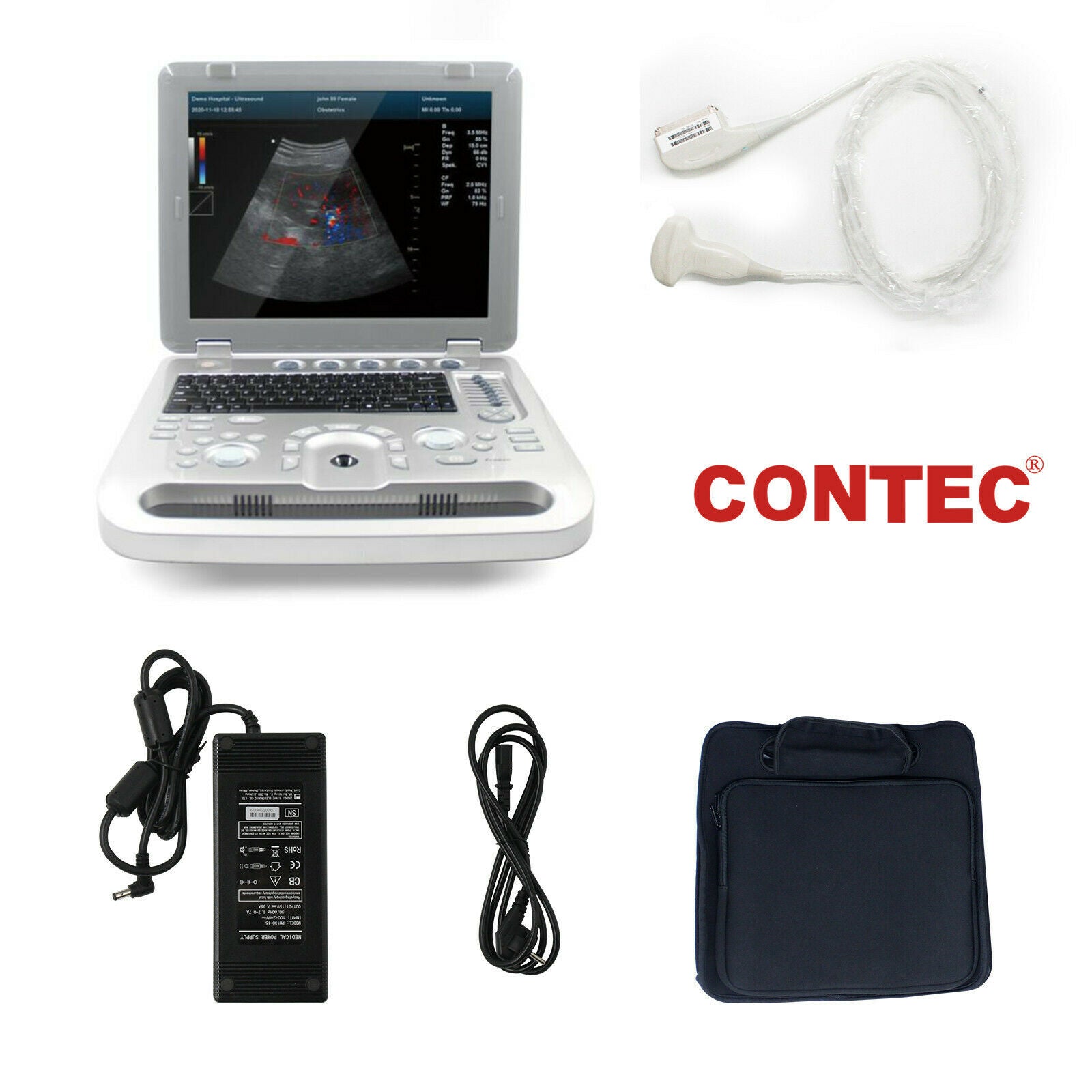 Laptop Color Doppler Ultrasound Scanner Power Doppler Diagnostic Machine System DIAGNOSTIC ULTRASOUND MACHINES FOR SALE