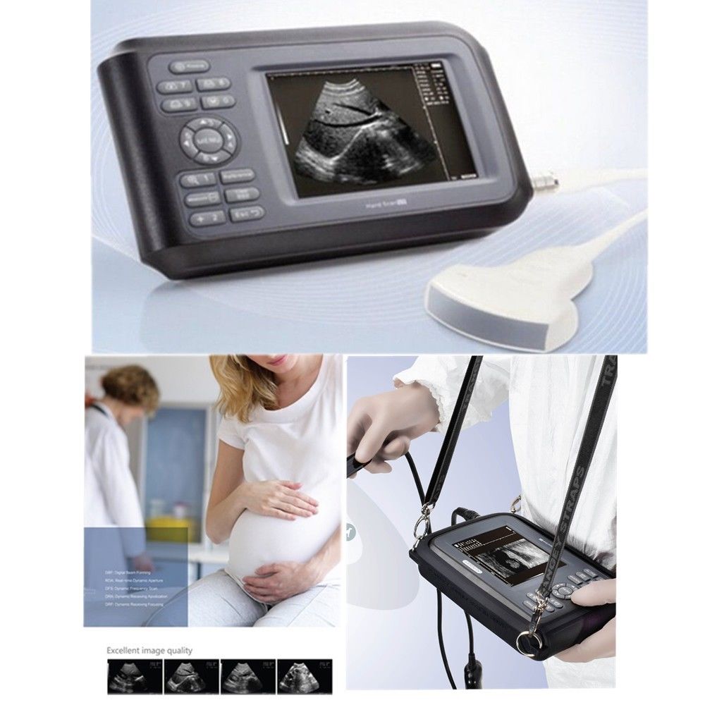 Laptop Ultrasound Scanner Machine System Convex Probe Abdominal Pregnancy Test 190891827272 DIAGNOSTIC ULTRASOUND MACHINES FOR SALE