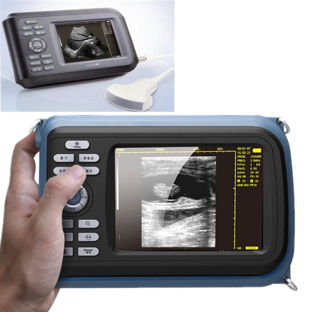 Sale Human Laptop Digital Ultrasound machine Scanner system 7.5Mhz Linear Probe 190891758767 DIAGNOSTIC ULTRASOUND MACHINES FOR SALE