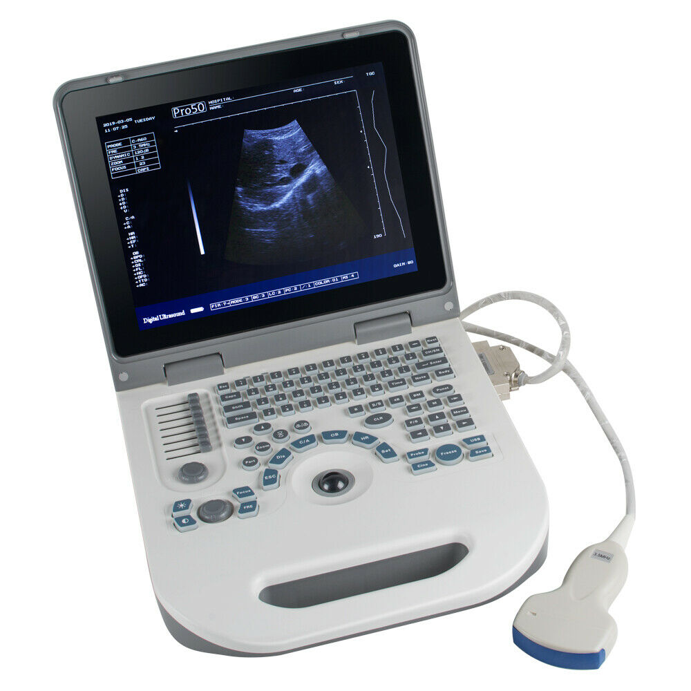 Portable Ultrasound Scanner Laptop Machine Safty Ultrasonic System+Convex Probe DIAGNOSTIC ULTRASOUND MACHINES FOR SALE