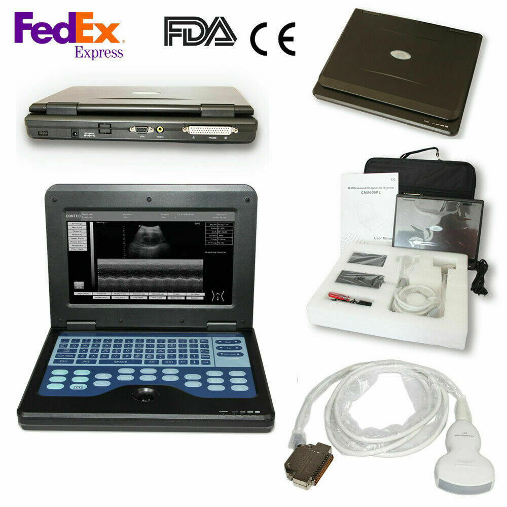 Digital Portable Ultrasound Machine Laptop Scanner with Convex Probe,US shipping 6945040100362 DIAGNOSTIC ULTRASOUND MACHINES FOR SALE