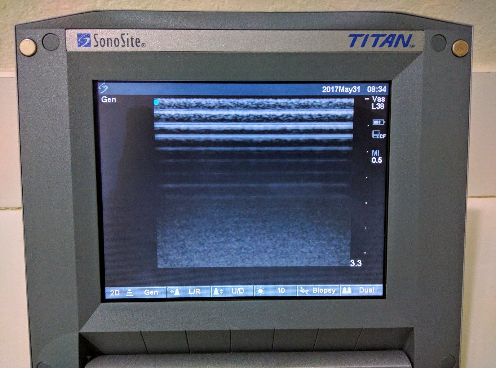 SONOSITE TITAN CV CW W/2 PROBES 1-L38 LINEAR & 1-C15 CURVED ARRAY CARDIAC DIAGNOSTIC ULTRASOUND MACHINES FOR SALE