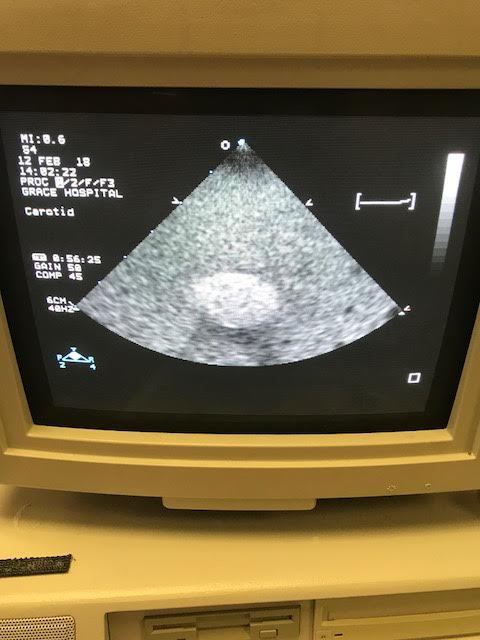 ultrasound monitor