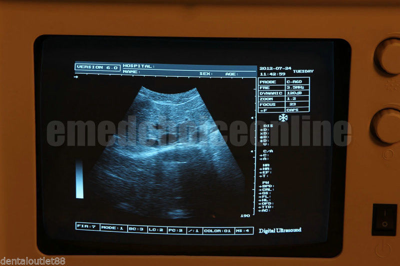 SALE 20% OFF！Ultrasound Machine Ultrasound Scanner with transvaginal probe +3D 190891893895 DIAGNOSTIC ULTRASOUND MACHINES FOR SALE