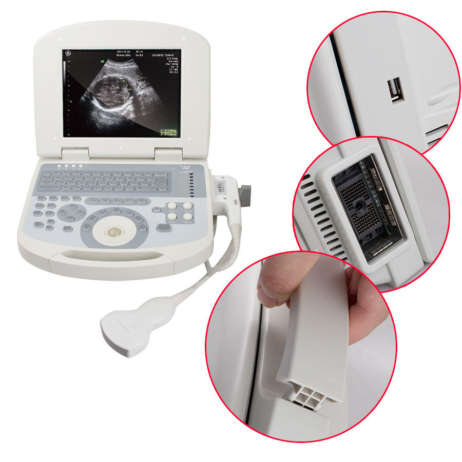 Portable Full Digital Laptop 10.4" Medical Ultrasound Scanner 3.5 Convex probe DIAGNOSTIC ULTRASOUND MACHINES FOR SALE