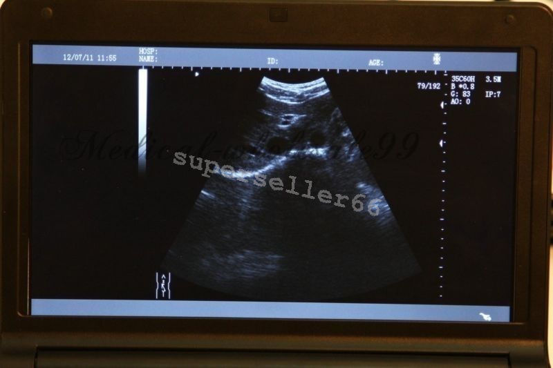 Portable Laptop Digital LCD 10.1 Inch Ultrasound scanner with Transvaginal Probe 190891563705 DIAGNOSTIC ULTRASOUND MACHINES FOR SALE