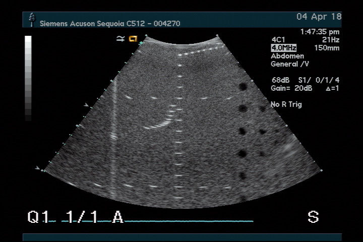 ACUSON 4C1 ULTRASOUND PROBE. REFURBISHED. WORKS FINE DIAGNOSTIC ULTRASOUND MACHINES FOR SALE