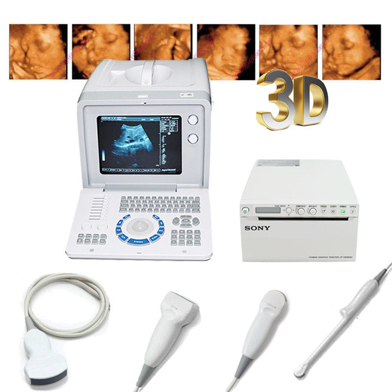 Medical Ultrasound Scanner,Convex,Linear,Transvaginal,Mico-convex Probe,Printer 190891973115 DIAGNOSTIC ULTRASOUND MACHINES FOR SALE