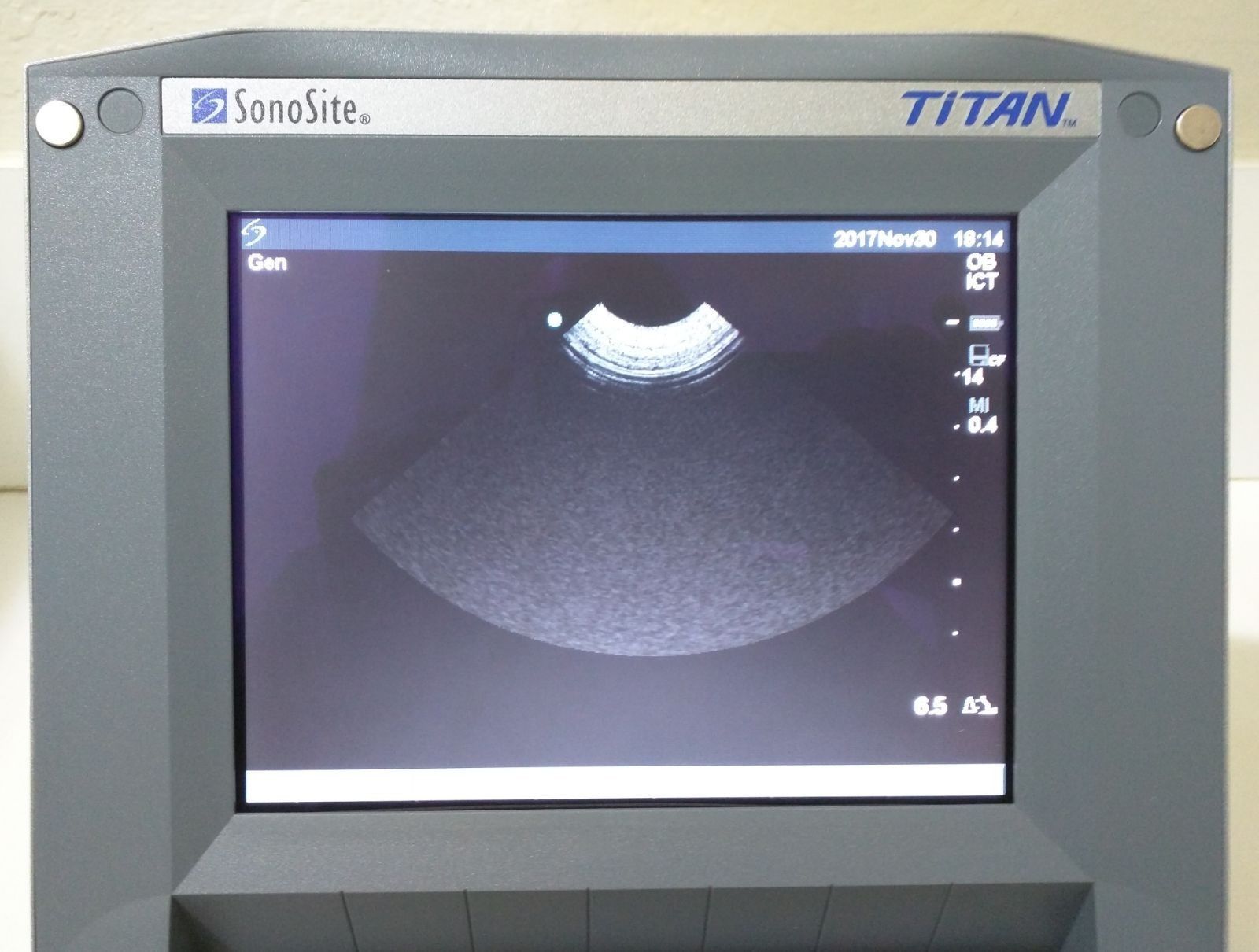 SONOSITE TITAN OB/GYN B/W W/2 PROBES 1-C60 CONVEX 1-ICT TRANSVAGINAL ULTRASOUND DIAGNOSTIC ULTRASOUND MACHINES FOR SALE