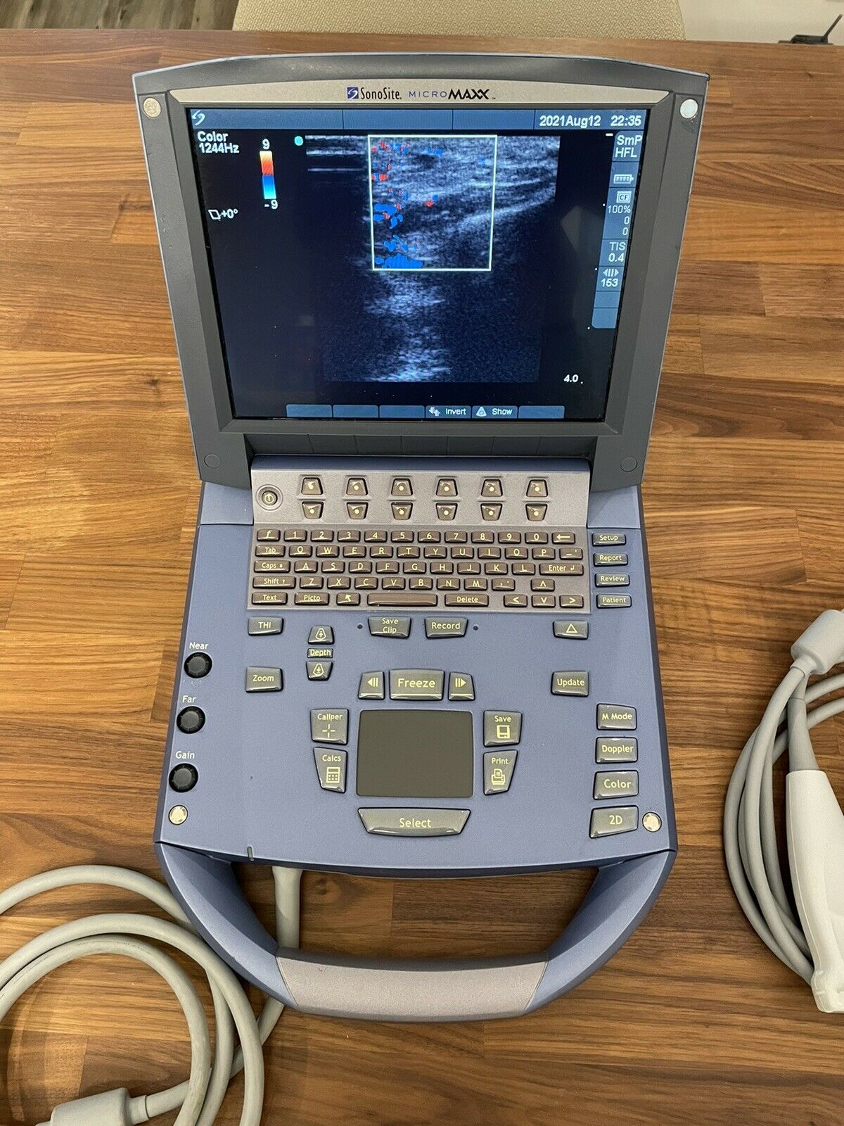 SONOSITE MICROMAXX 2008 CW DOPPLER W/ 2 Probes PORTABLE ULTRASOUND DIAGNOSTIC ULTRASOUND MACHINES FOR SALE