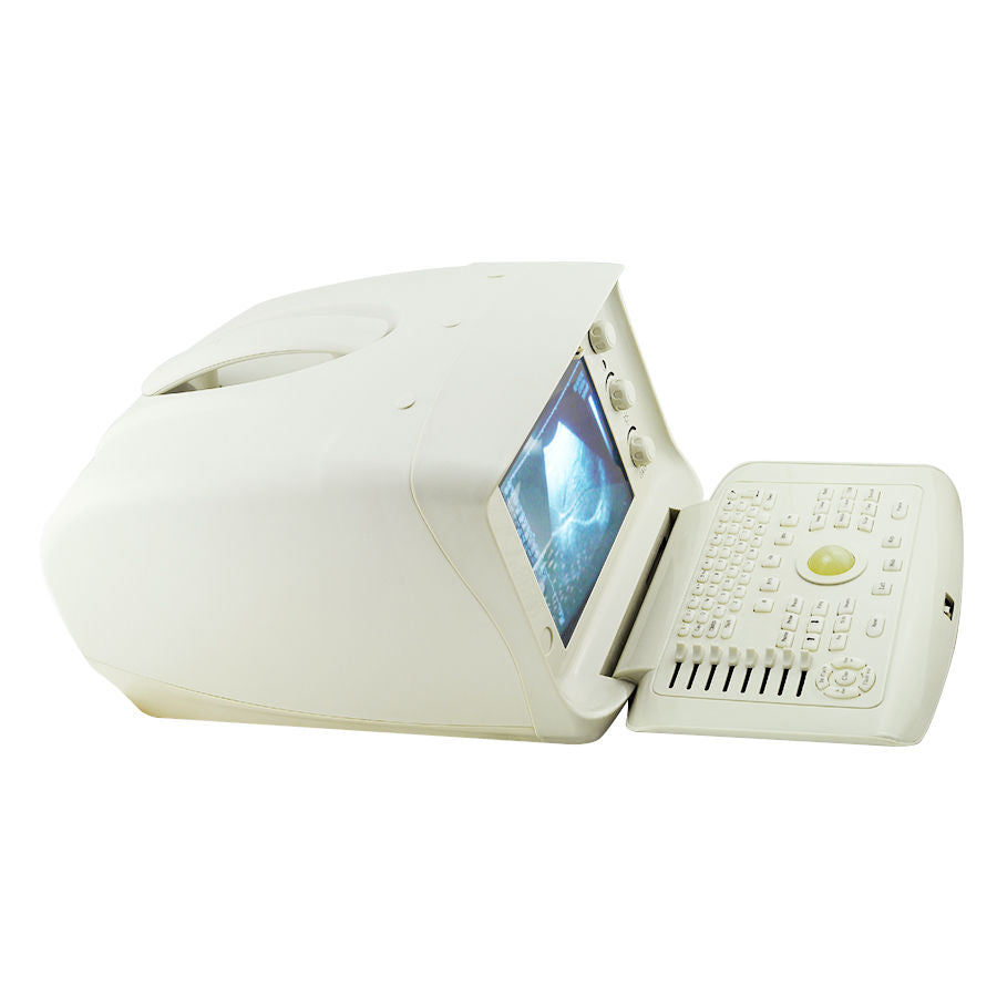 Medical Ultrasound Scanner Machine System CE, Convex + Transvaginal 2 Probe 3D 190891052773 DIAGNOSTIC ULTRASOUND MACHINES FOR SALE