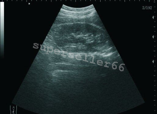 Portable Laptop Digital LCD 10.1 Inch Ultrasound scanner with Transvaginal Probe 190891563705 DIAGNOSTIC ULTRASOUND MACHINES FOR SALE