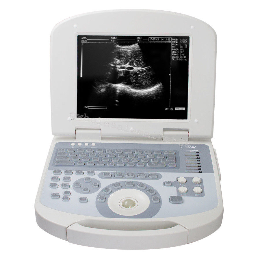 Portable Ultrasound Machine Scanner System Convex probe 3D Software Image Photo 190891045898 DIAGNOSTIC ULTRASOUND MACHINES FOR SALE