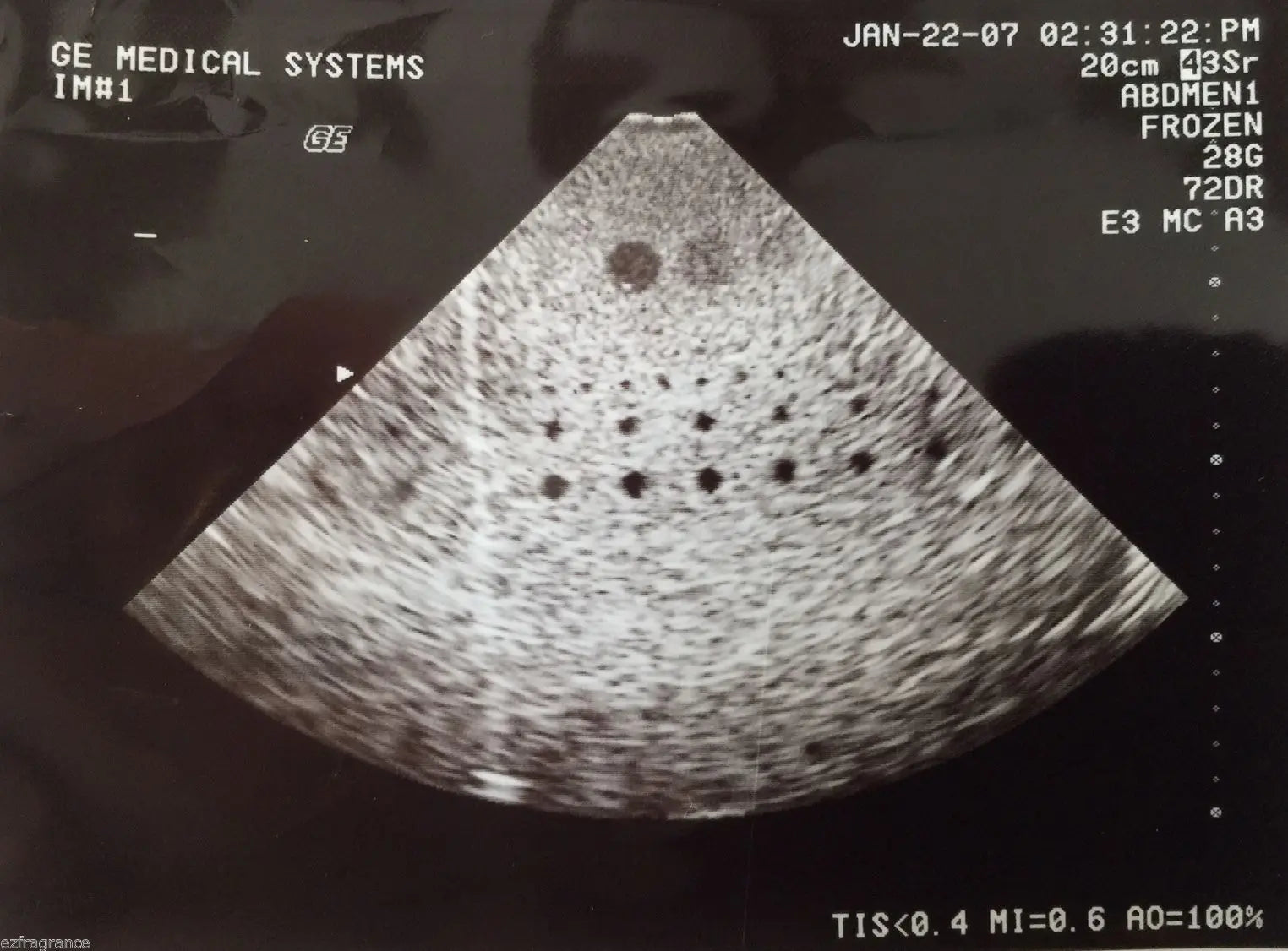 GE 3Sr Sector Cardiac Ultrasound Transducer Probe-Fully Tested For GE Logiq 700 DIAGNOSTIC ULTRASOUND MACHINES FOR SALE