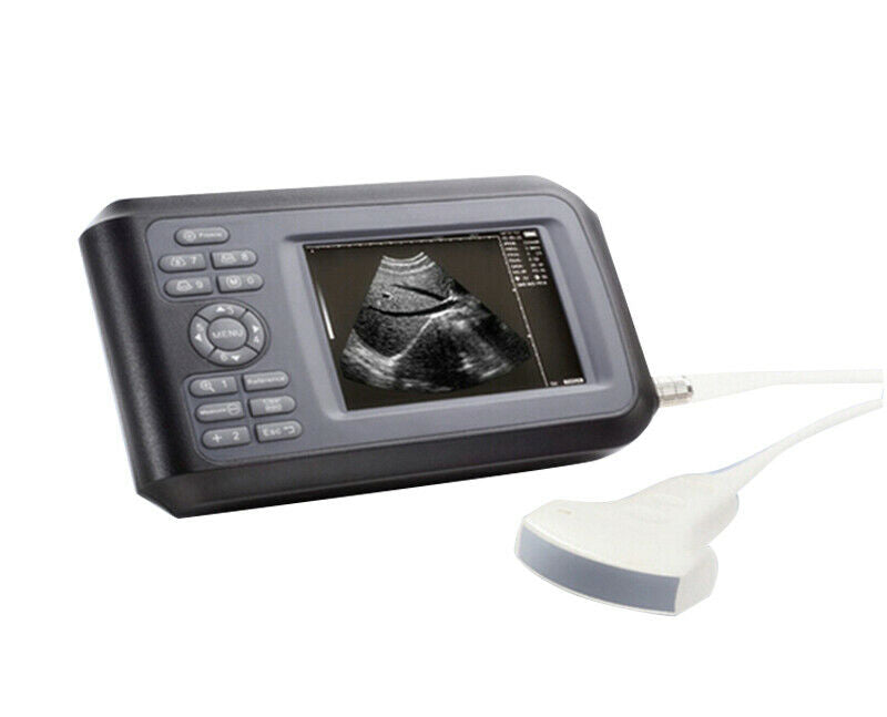 Digital LCD Ultrasound Scanner Machine Human Use With R40 3.5Mhz Convex Probe DIAGNOSTIC ULTRASOUND MACHINES FOR SALE