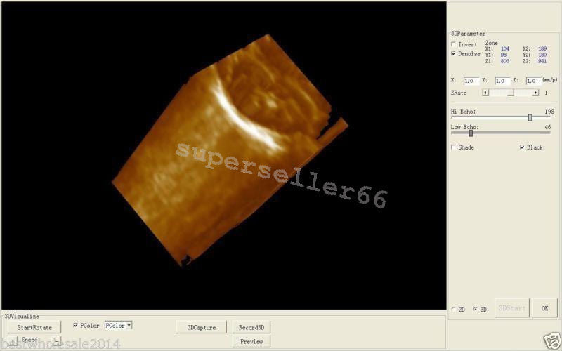 Portable Laptop Digital LCD 10.1 Inch Ultrasound scanner with Transvaginal Probe 190891563705 DIAGNOSTIC ULTRASOUND MACHINES FOR SALE