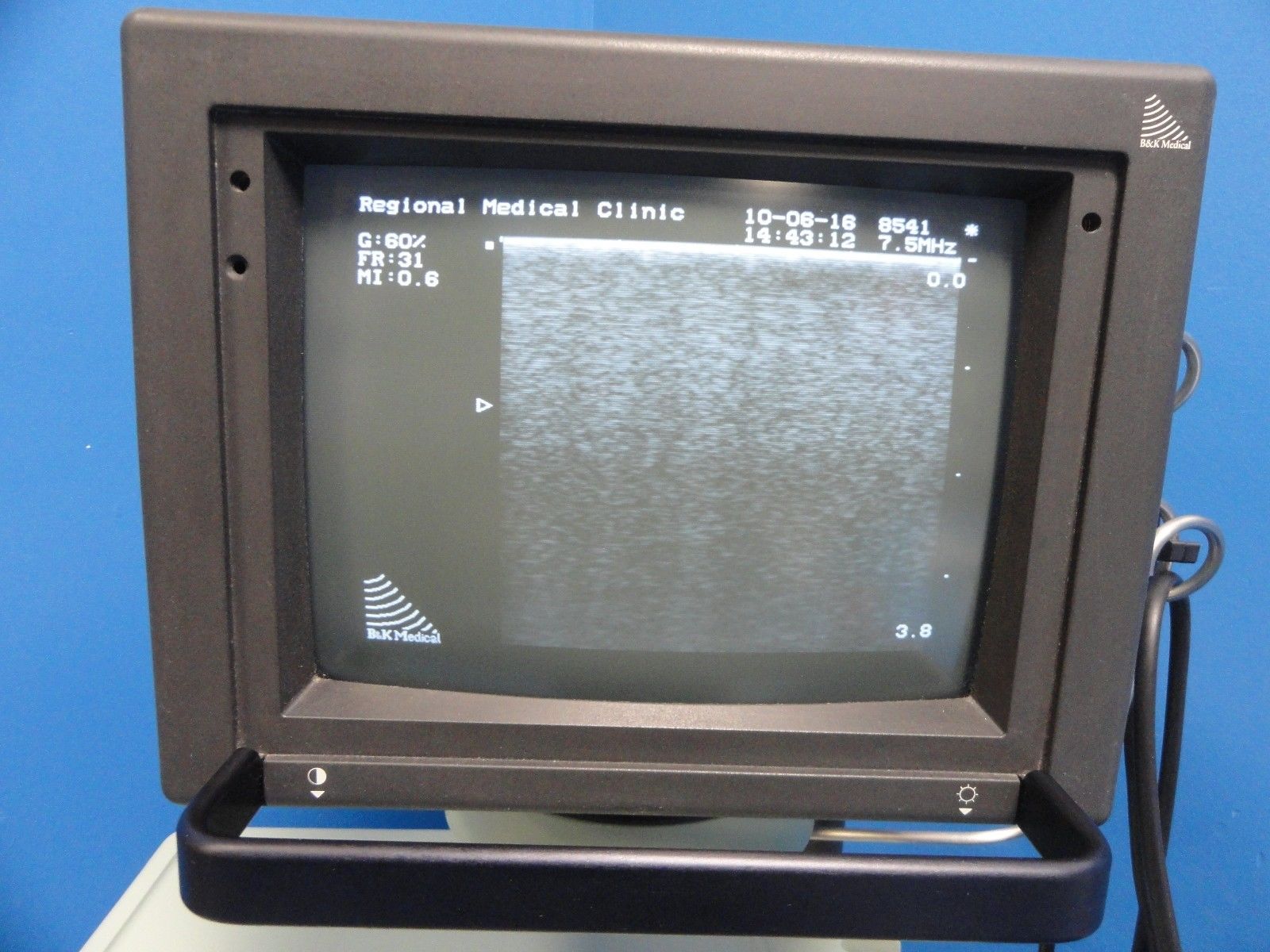 BK Medical Leopard 2001 Ultrasound W/ 8451& 8560 Linear Probes &Printer (11449) DIAGNOSTIC ULTRASOUND MACHINES FOR SALE