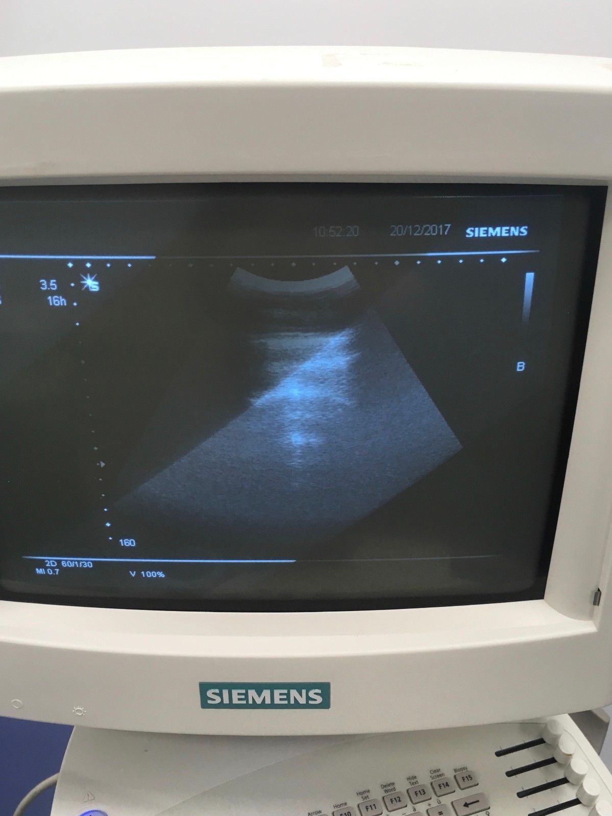 2008 Siemens Sonoline G20 Ultrasound 08648847 w/ C5-2 DIAGNOSTIC ULTRASOUND MACHINES FOR SALE