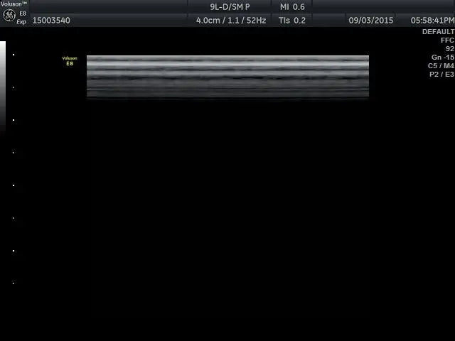 GE 9L-D Ultrasound Transducer DIAGNOSTIC ULTRASOUND MACHINES FOR SALE