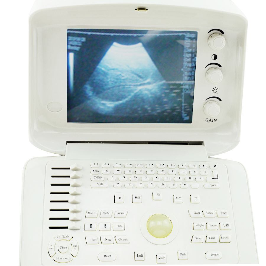 New Digital Ultrasound Scanner Machine System CE, Convex + Transvaginal Probe 3D 190891052773 DIAGNOSTIC ULTRASOUND MACHINES FOR SALE