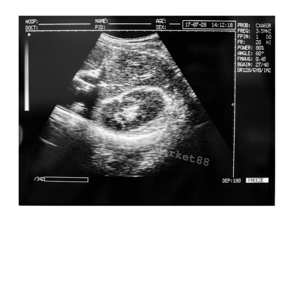 Laptop Ultrasound Machine Scanner Convex Probe 3D Software High Resolution Clear 190891045898 DIAGNOSTIC ULTRASOUND MACHINES FOR SALE