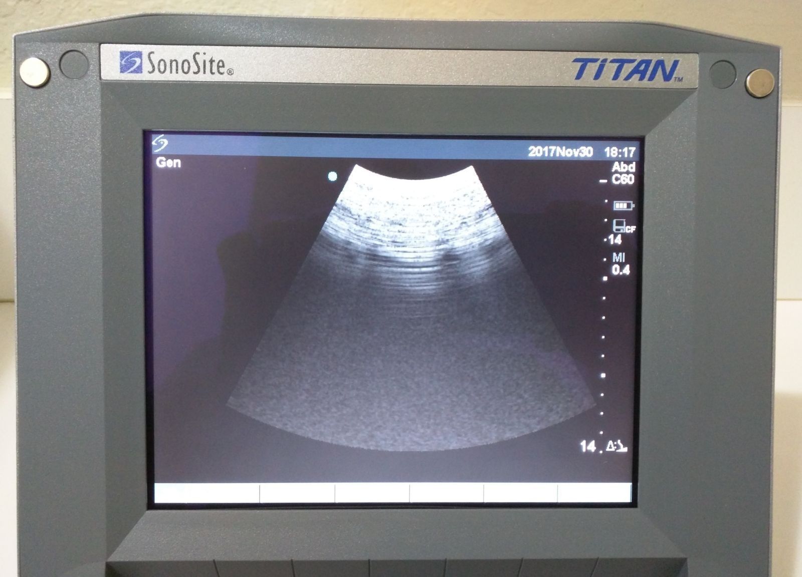 SONOSITE TITAN OB/GYN B/W W/2 PROBES 1-C60 CONVEX 1-ICT TRANSVAGINAL ULTRASOUND DIAGNOSTIC ULTRASOUND MACHINES FOR SALE