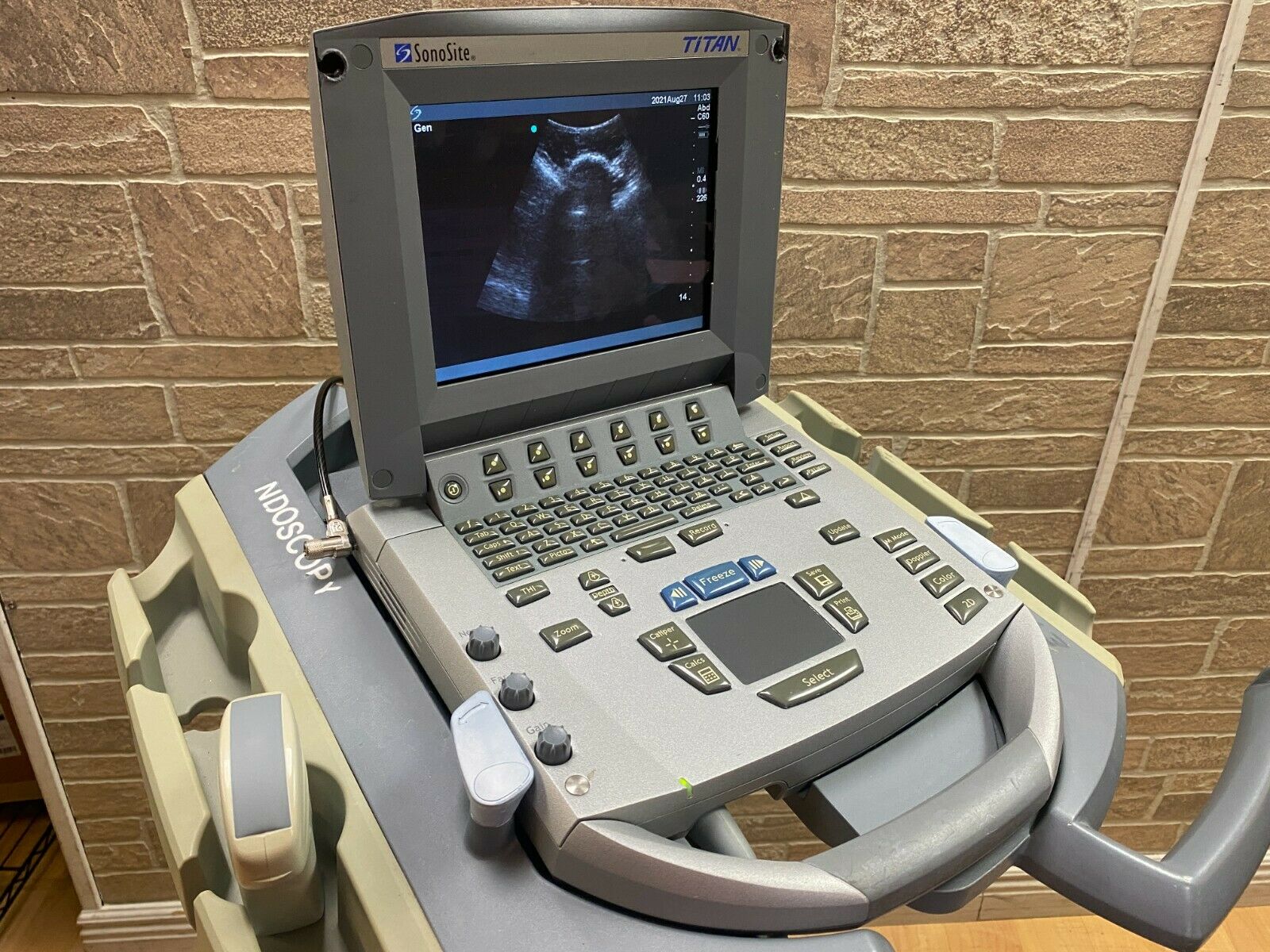 SONOSITE TITAN PORTABLE ULTRASOUND MACHINE WITH 1 PROBE (C60) DIAGNOSTIC ULTRASOUND MACHINES FOR SALE