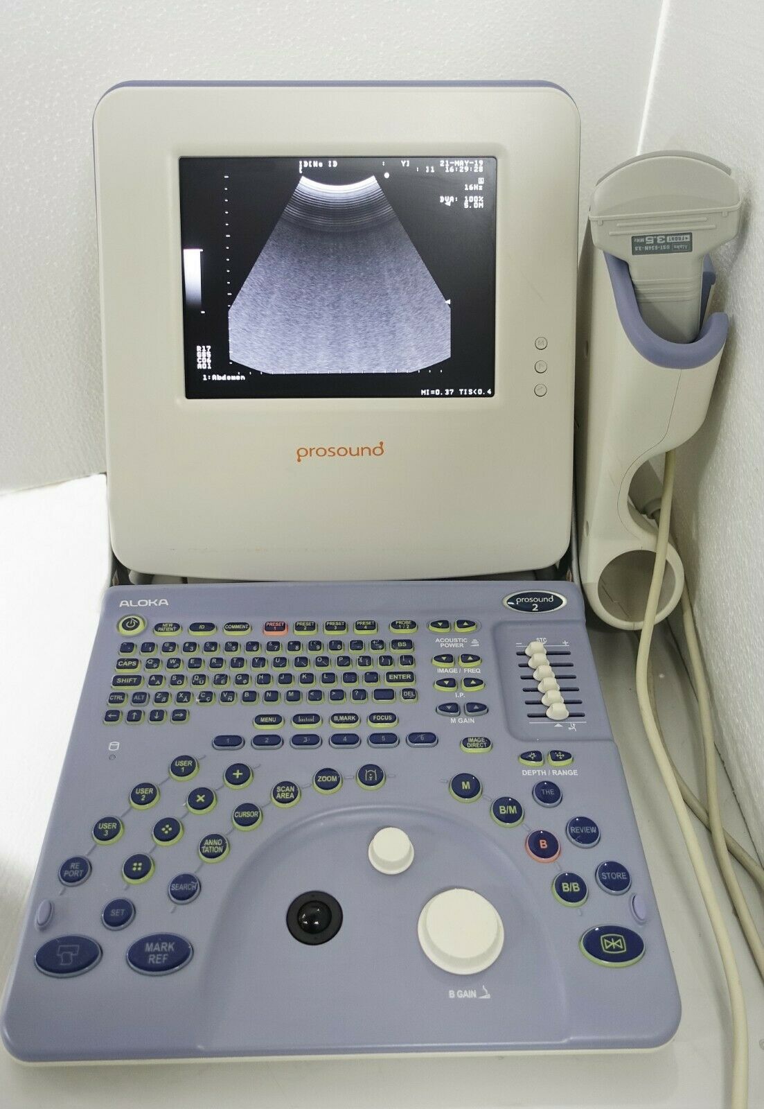 HITACHI ALOKA PROSOUND 2 DIAGNOSTIC ULTRASOUND P2 PORTABLE w UST-934N-3.5 PROBE DIAGNOSTIC ULTRASOUND MACHINES FOR SALE