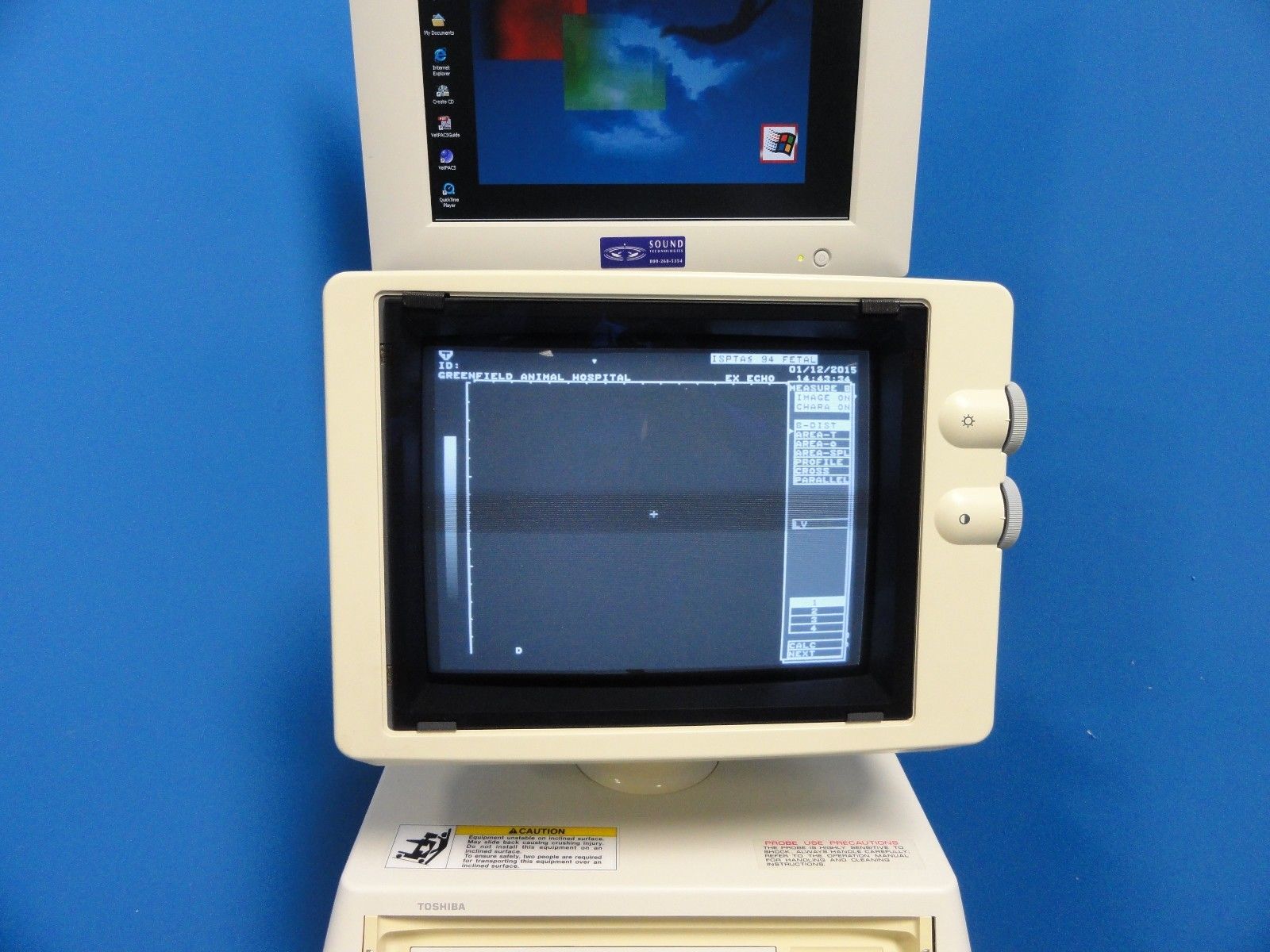 Toshiba Just Vision 400 SSA-325A Diagnosic Vet Ultrasound W/ Computer & Monitor DIAGNOSTIC ULTRASOUND MACHINES FOR SALE