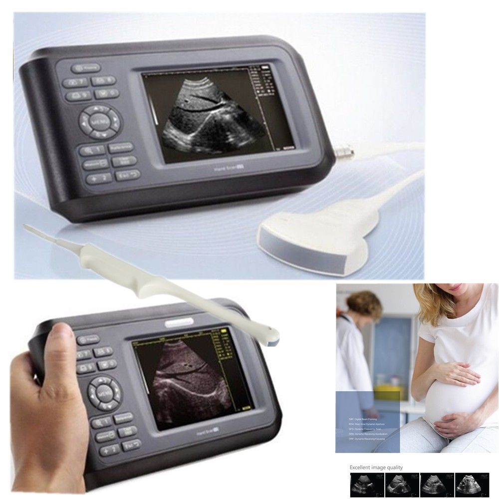 Laptop Ultrasound Scanner Machine System Convex Probe Abdominal Pregnancy Test 190891827272 DIAGNOSTIC ULTRASOUND MACHINES FOR SALE