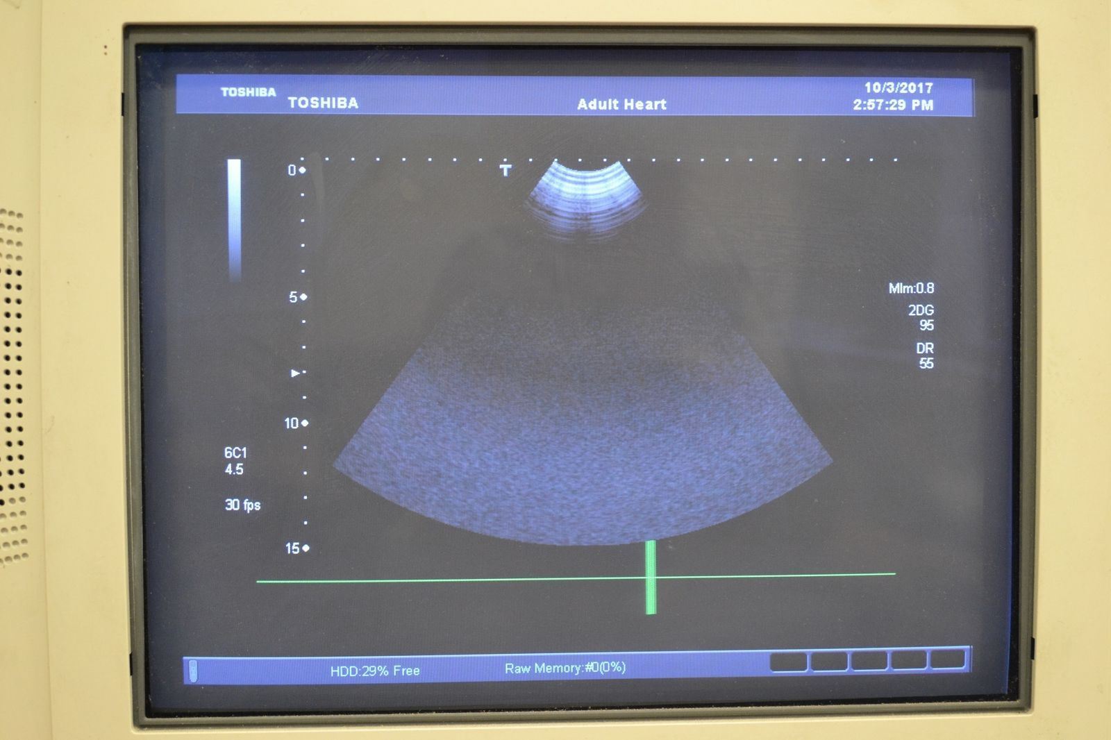 Toshiba Viamo PVT-382BT 5.5-1.8MHz Convex Ultrasound Transducer Probe J1639 DIAGNOSTIC ULTRASOUND MACHINES FOR SALE