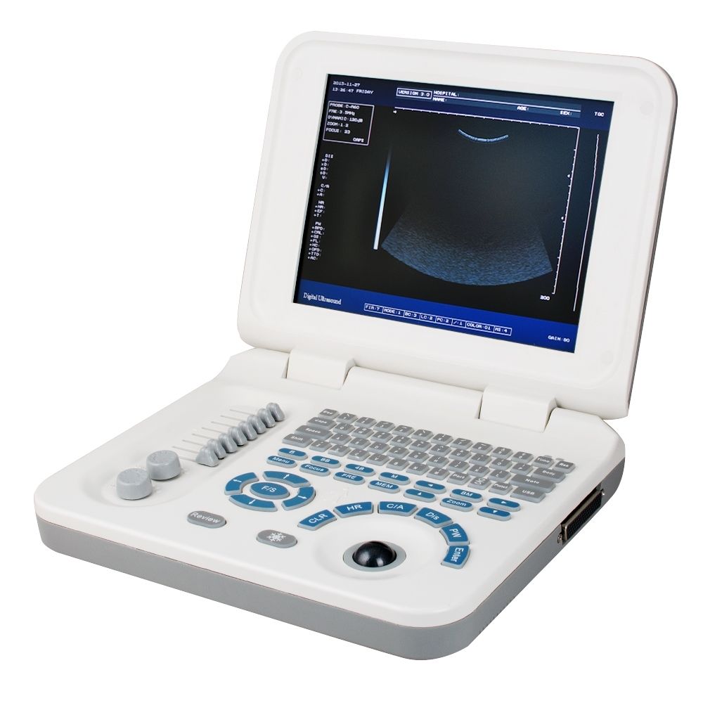 USB 10 " Nootbook Full Digital Ultrasound Scanner Machine  Micro-convex Probe 3D 190891218131 DIAGNOSTIC ULTRASOUND MACHINES FOR SALE