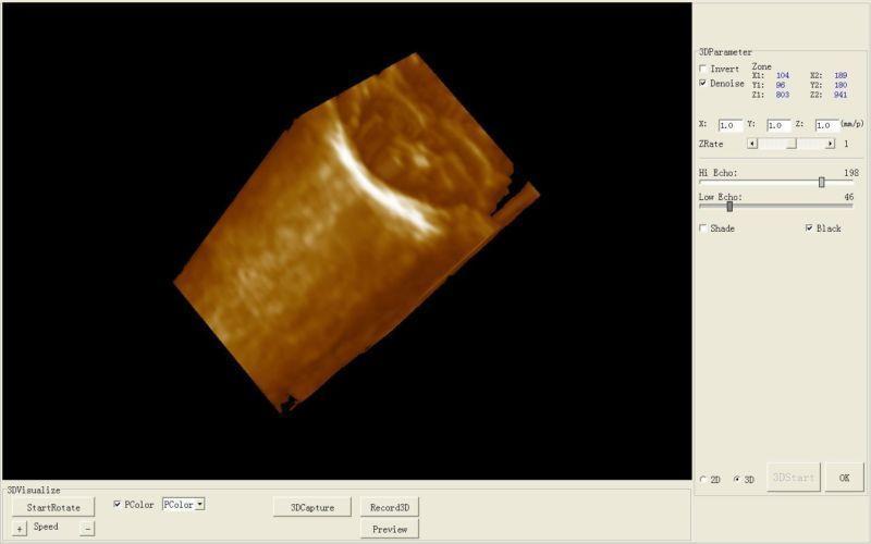 Sale 12 inch Ultrasound Scanner Digital Machine+Convex &Linear 2 Probes+3D Image 190891926722 DIAGNOSTIC ULTRASOUND MACHINES FOR SALE