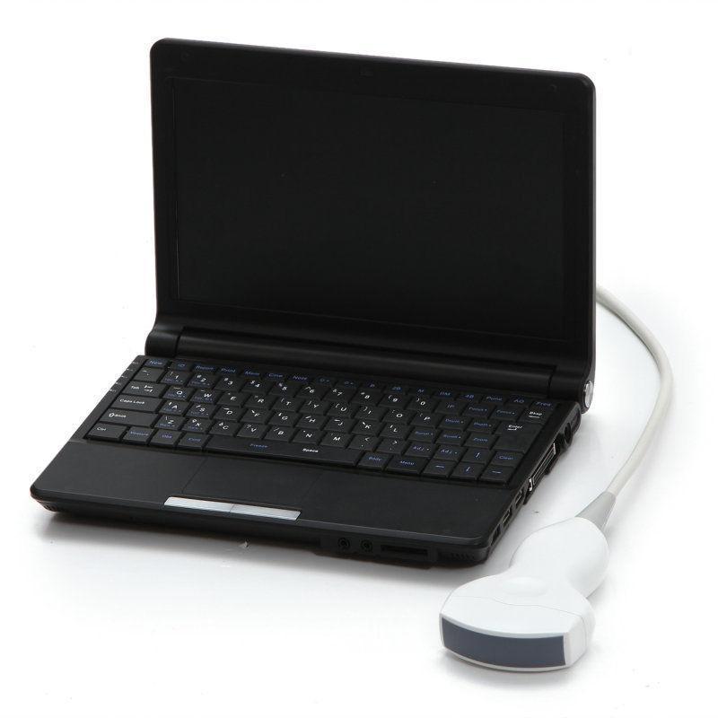 Digital Laptop Ultrasound Scanner  Convex + Linear Probe 3D Ultrasound Pregnant DIAGNOSTIC ULTRASOUND MACHINES FOR SALE