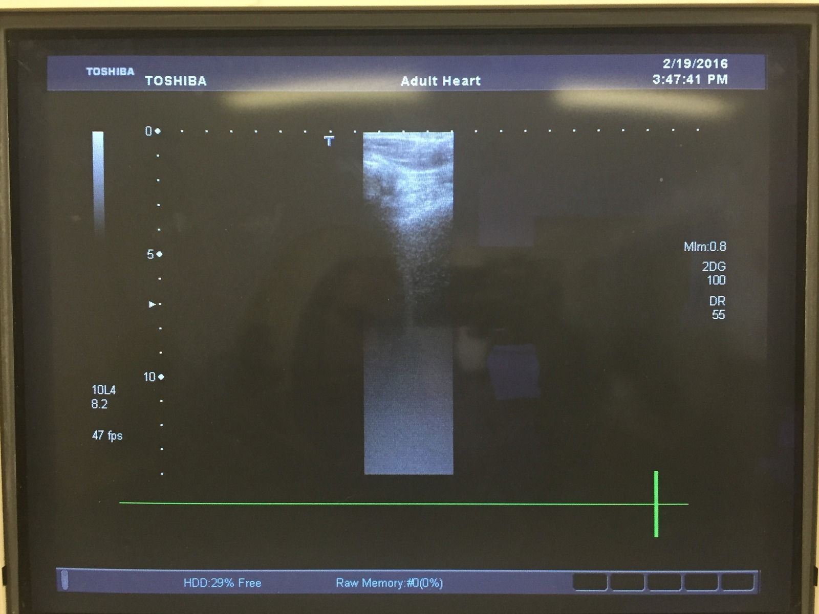 Toshiba Aplio PLT-604AT 6.0MHz Linear Ultrasound Transducer Medical Equipment DIAGNOSTIC ULTRASOUND MACHINES FOR SALE