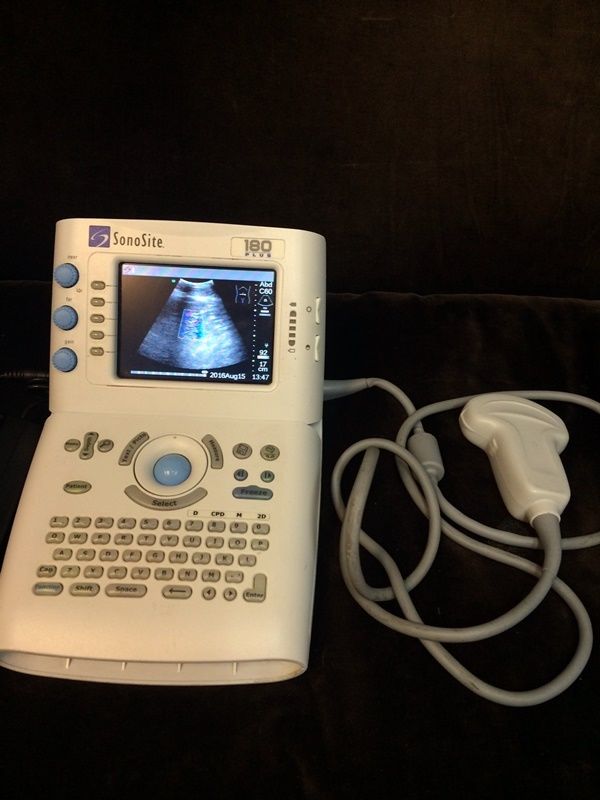 Sonosite 180 Plus portable ultrasound, 2006, 180+ DIAGNOSTIC ULTRASOUND MACHINES FOR SALE