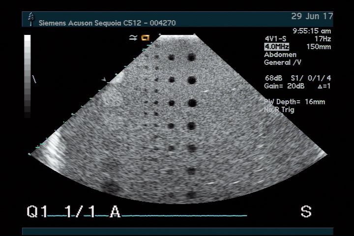 Acuson 4V1 for Sequoia 512 Ultrasound Transducer DIAGNOSTIC ULTRASOUND MACHINES FOR SALE