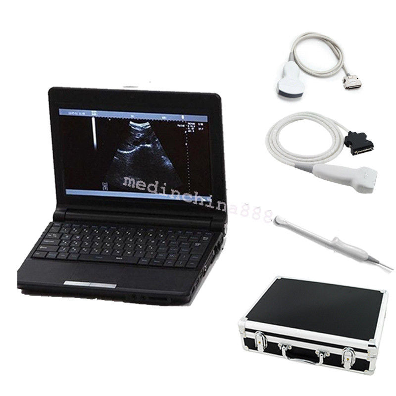 Newest Laptop Ultrasound Scanner +Convex+Linear+Transvaginal 3 Probes +Free Box DIAGNOSTIC ULTRASOUND MACHINES FOR SALE
