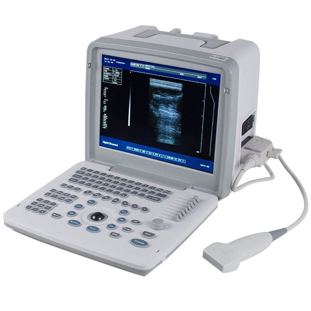 Hospital Digital SVGA LCD Portable Ultrasound Scanner Machine Linear Probe 3D 190891567833 DIAGNOSTIC ULTRASOUND MACHINES FOR SALE