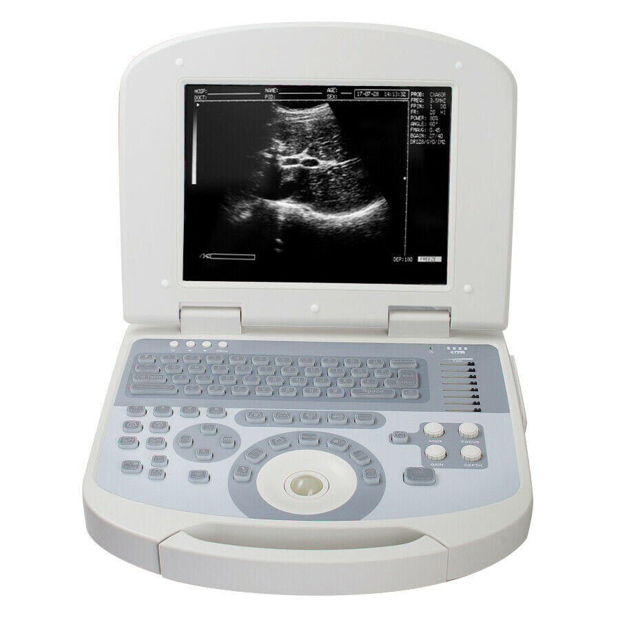 Digital Medical Ultrasound Scanner With 3.5MHZ Convex Probe 3D Image Pregnancy DIAGNOSTIC ULTRASOUND MACHINES FOR SALE