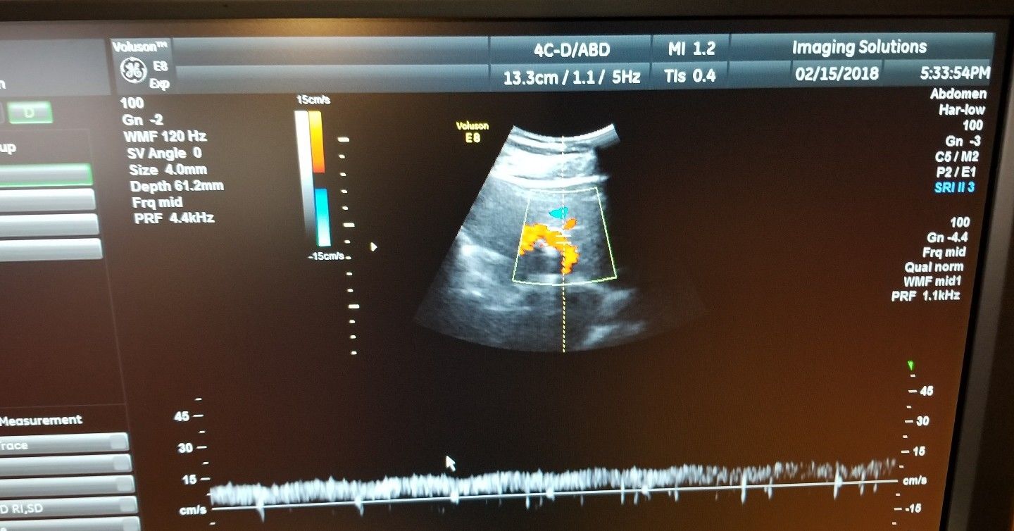 GE 4C-D Ultrasound Probe/Transducer