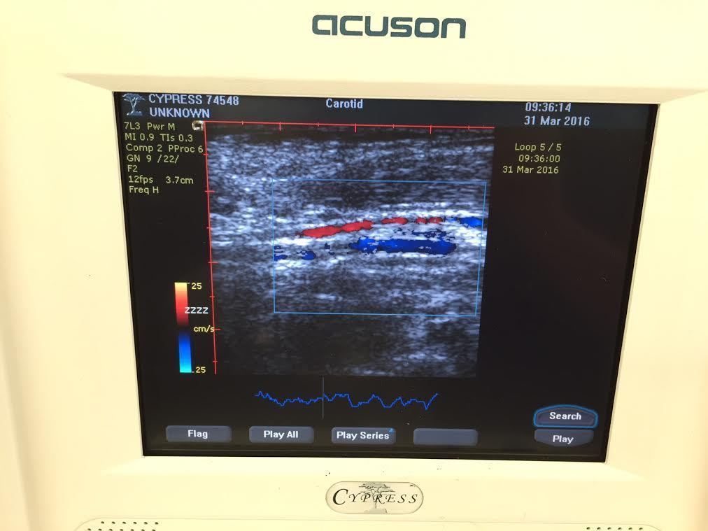 Acuson 7L3 Linear/Vascular Probe Transducer DIAGNOSTIC ULTRASOUND MACHINES FOR SALE