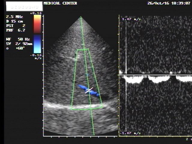 Esaote Biosound Megas/ MyLab ultrasound PA220 cardiac probe DIAGNOSTIC ULTRASOUND MACHINES FOR SALE
