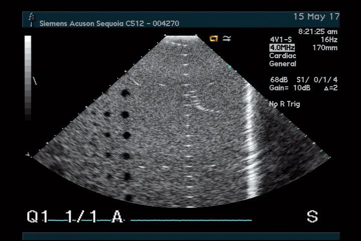 Acuson 4V1 for Sequoia Ultrasound Transducer DIAGNOSTIC ULTRASOUND MACHINES FOR SALE